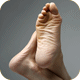 Bunion Relief